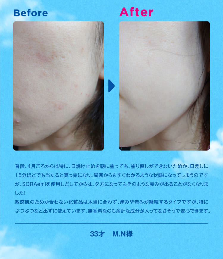 口コミ１