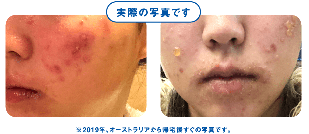 実際の写真