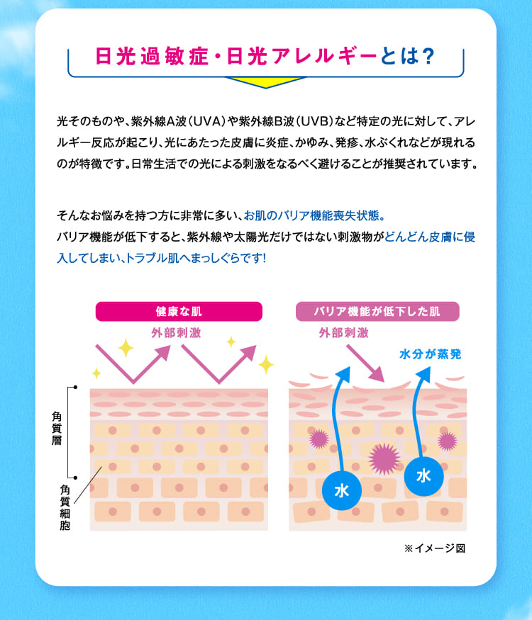 日光過敏症、日光アレルギーとは？