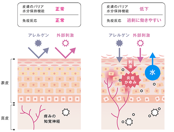 解説図