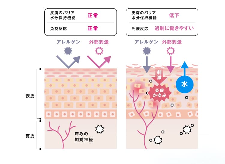 解説図